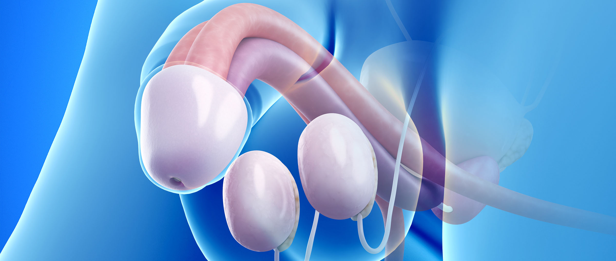 Cryptorchidism